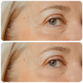 Cargar la imagen en la vista de la galería, Revitalize Your Skin: Ultimate Anti-Aging Skincare Kit